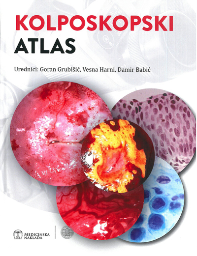 Kolposkopski atlas