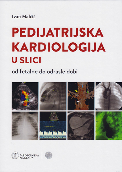 Pedijatrijska kardiologija u slici