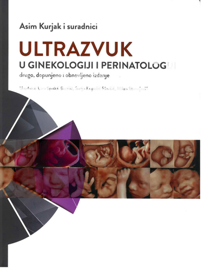 Ultrazvuk u ginekologiji i perinatologiji