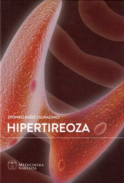 Hipertireoza