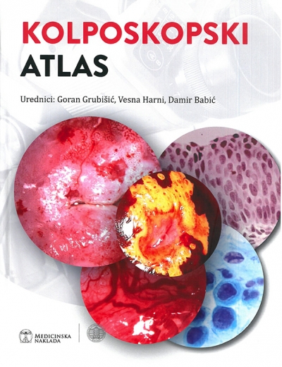 Kolposkopski atlas