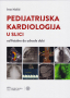 Pedijatrijska kardiologija u slici